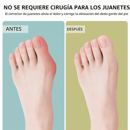 CORRECTOR DE JUANETES